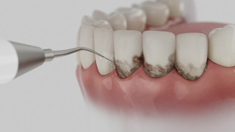 Trusted Wisdom Tooth Removal service in Denver, PA - Dentist Open Now